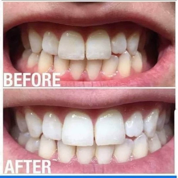 AP 24® Whitening Fluoride-Free Toothpaste - Picture 4 of 4